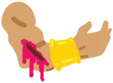 Fehlender Arm