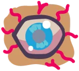 Nervenschaden