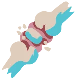 Kaputte Knie
