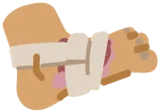 Gebrochener Fuß